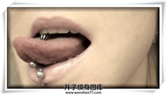 舌钉图片案例