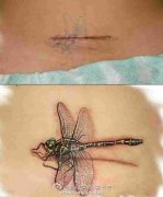 <b>腹部疤痕遮盖 蜻蜓纹身图案</b>