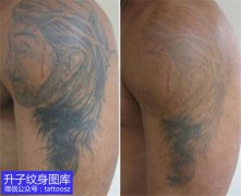 <b> 重庆洗纹身 大臂外侧耶稣纹身清洗后的效果</b>