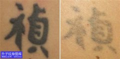 <b>重庆洗纹身 手臂文字清洗纹身后的效果图</b>