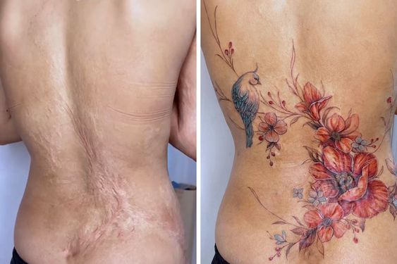 侧腰遮盖疤痕植物花卉纹身图案